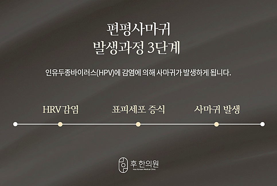 편평사마귀 발생과정 3단계 다이어그램, HPV 감염부터 표피세포 증식, 사마귀 발생까지의 과정