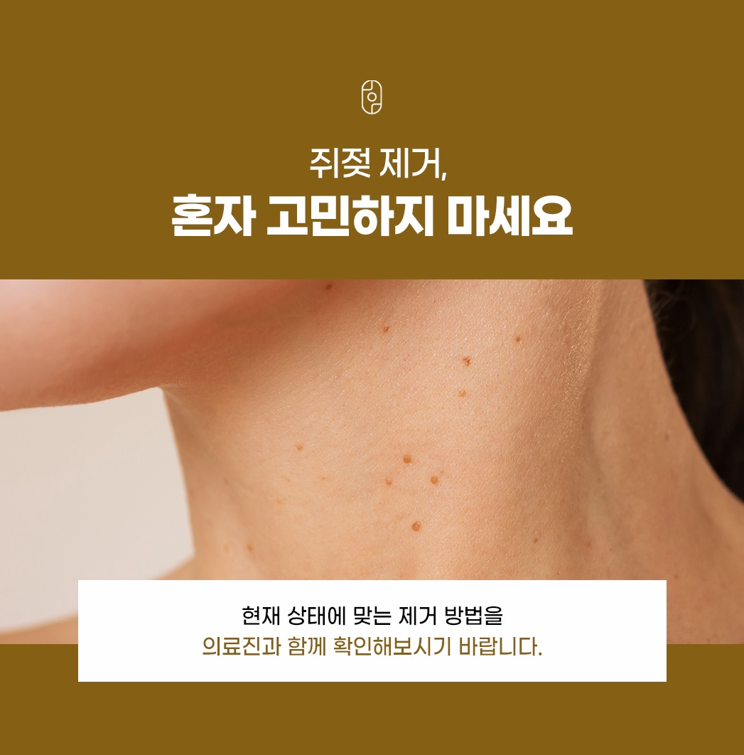 쥐젖 제거 상담 안내