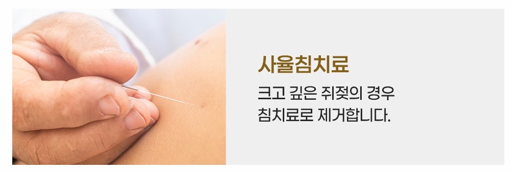 후한의원 사율침치료