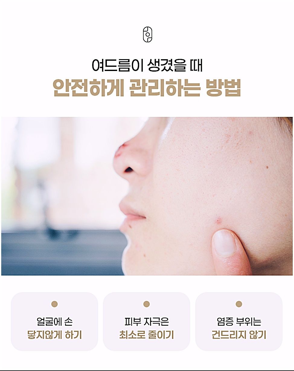 광주여드름 피부과 찾는다면? 얼굴에 손 닿지 않게 하고 피부 자극과 염증 부위 자극을 최소화해야 한다는 안전 관리법 안내