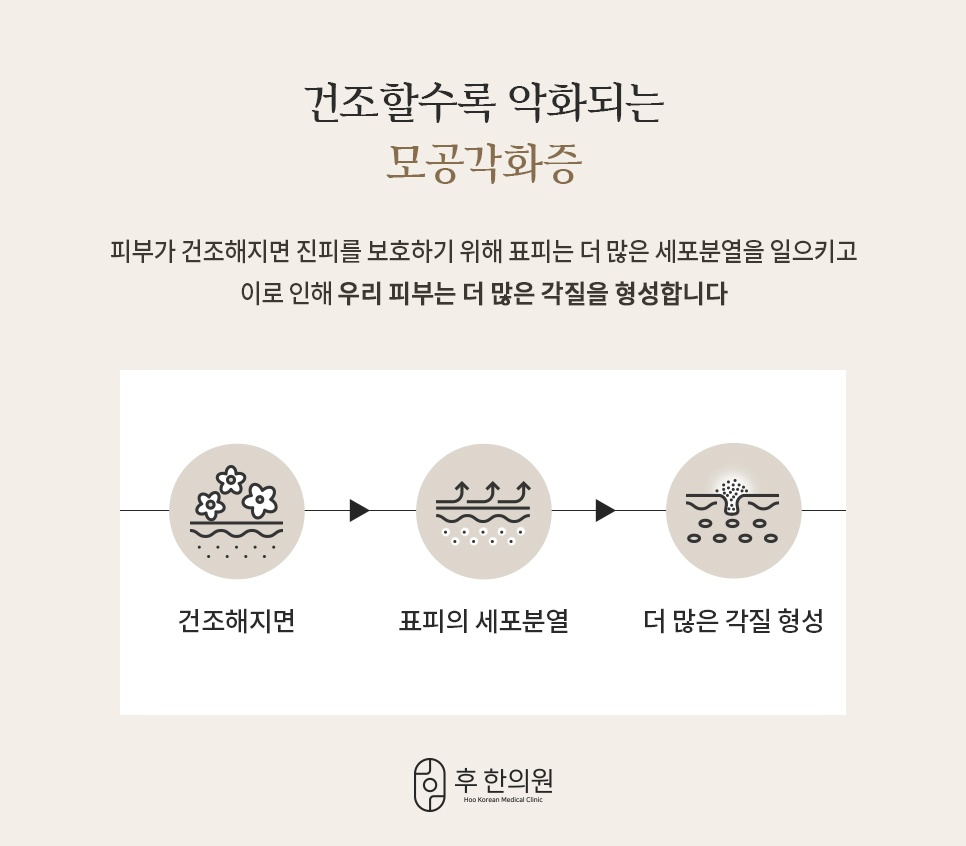 피부가 건조해질 때 각질이 늘어나는 모공각화증 발생 과정