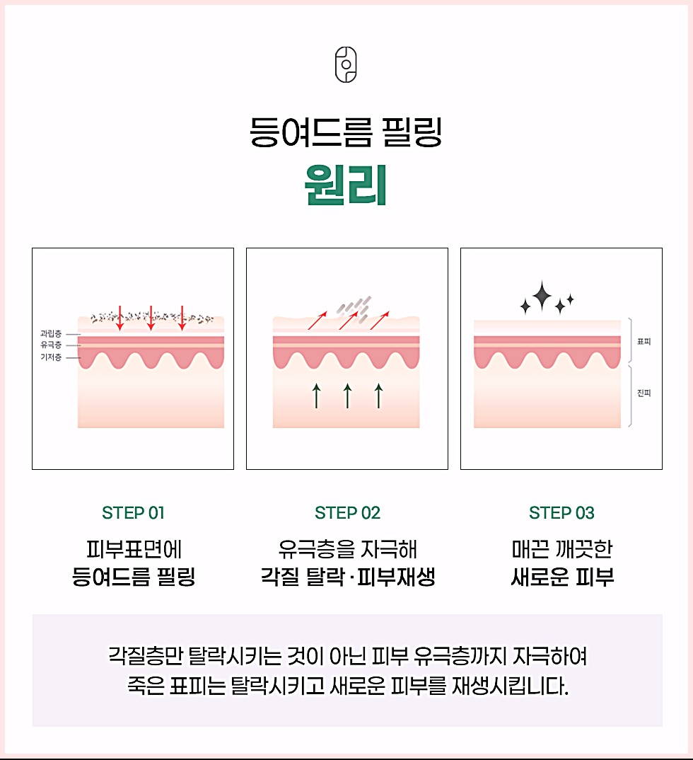 등여드름 필링 원리 STEP 1-2-3 단계별 피부 재생 과정 설명 그래픽