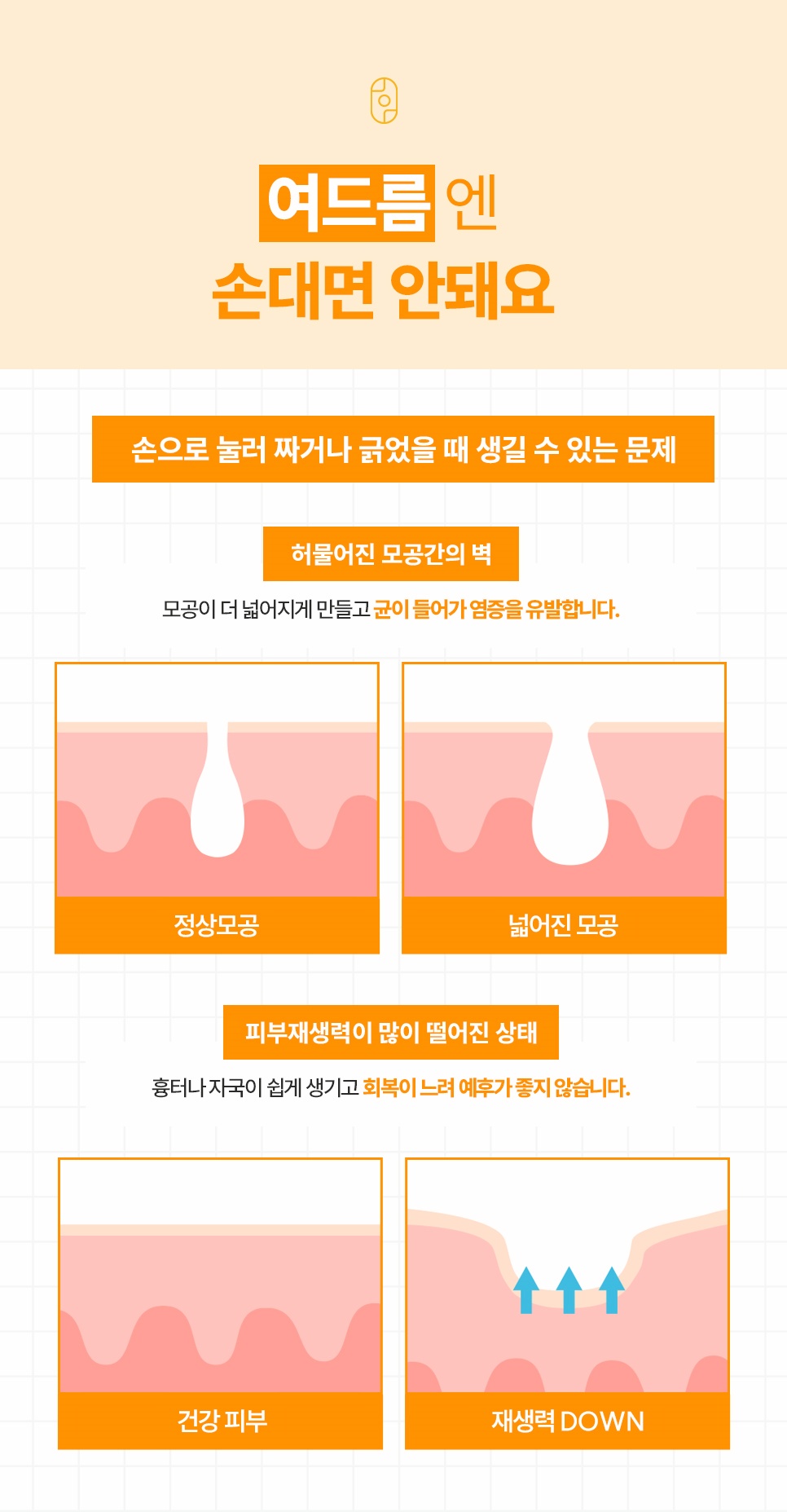 여드름을 잘못 짜면 생기는 모공 확장 및 피부 재생력 저하 문제