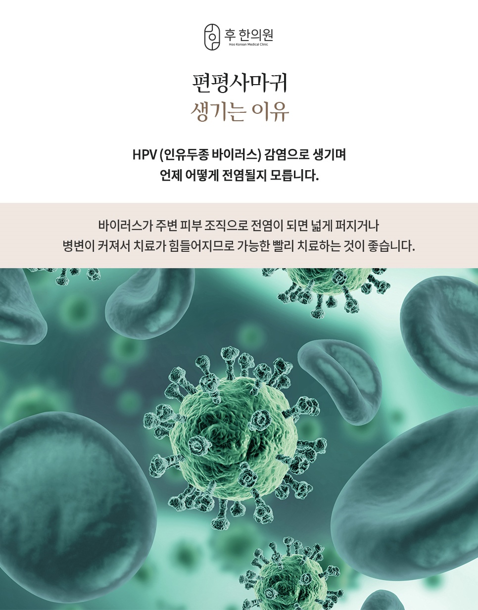 인유두종 바이러스 감염으로 번지는 편평사마귀의 발생 원리를 현미경 이미지로 표현한 안내