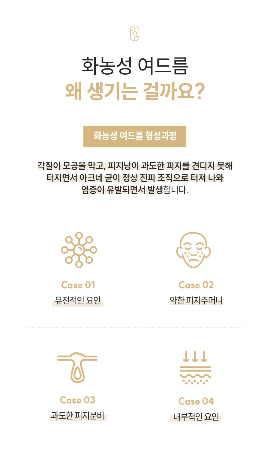 각질·피지·아크네균 염증으로 화농성 여드름이 생기는 4가지 원인