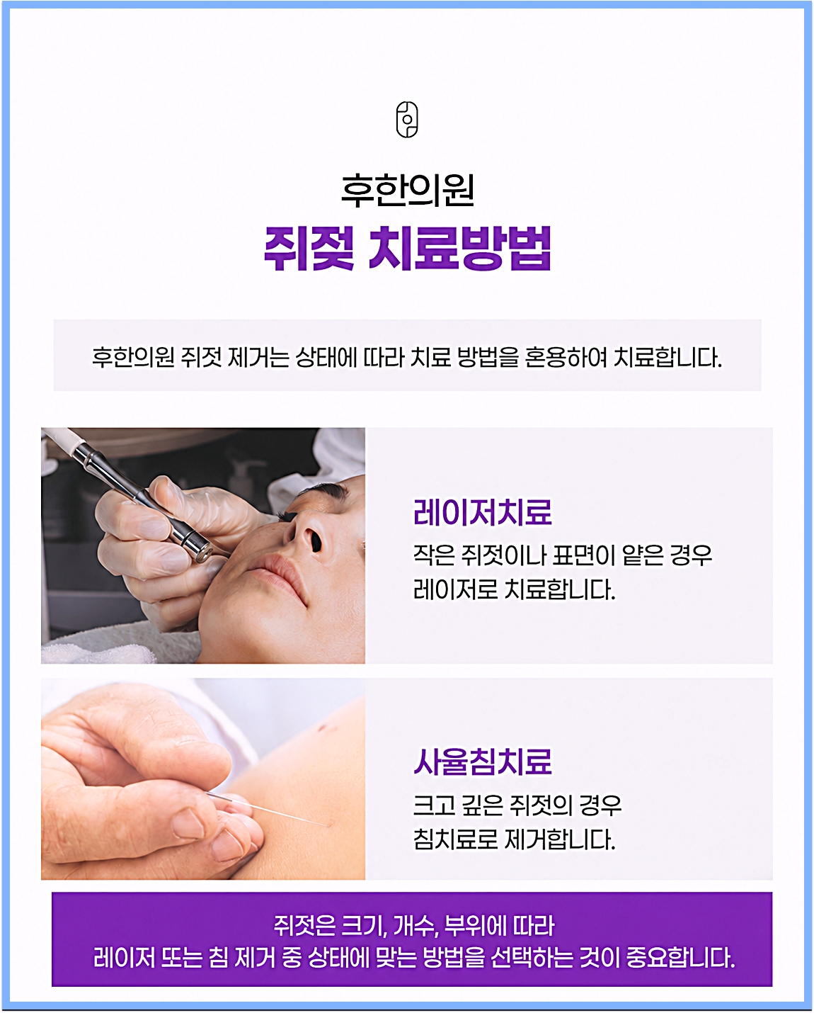 후한의원 쥐젖 시술 방식, 레이저치료와 사율침치료 안내