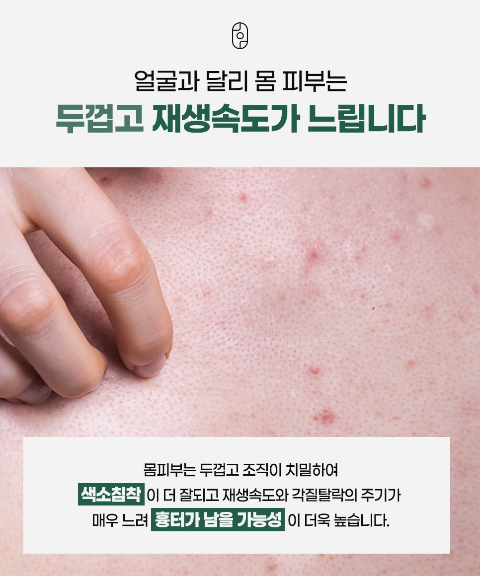 얼굴보다 두껍고 조직이 치밀한 몸 피부는 색소침착이 잘 남고 재생속도가 느려 흉터 가능성이 높다는 안내