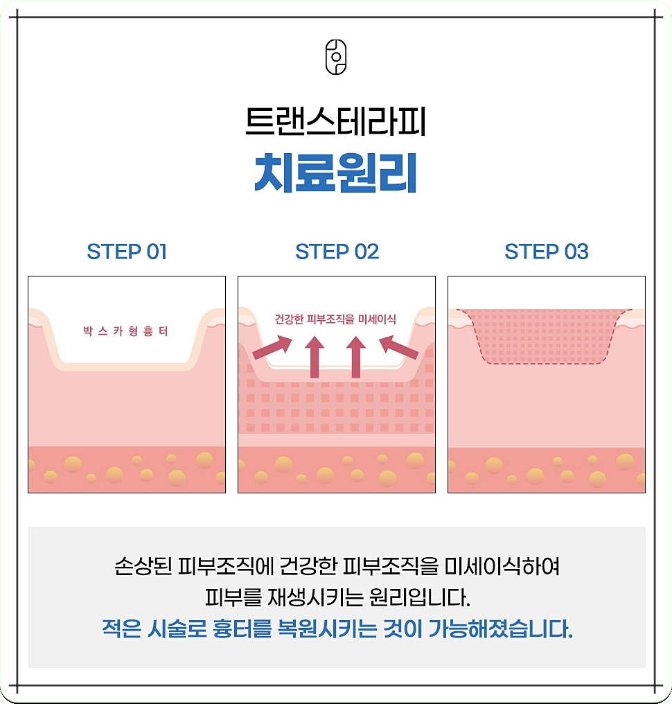 광주흉터치료 새살침 치료원리